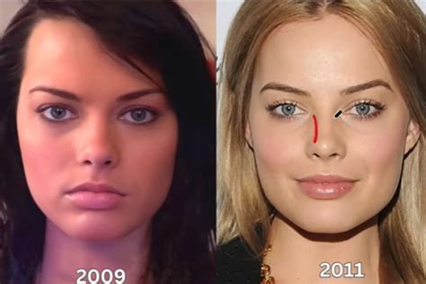 margot robbie before and after surgery|How many plastic surgeries did Margot Robbie get done to look。